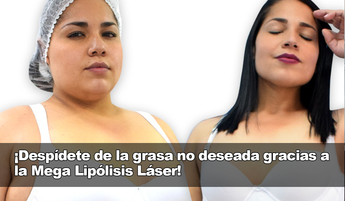 La Mega Lipólisis Láser, la solución definitiva para erradicar la grasa no deseada